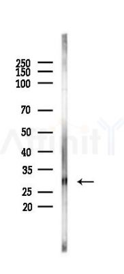CDK5 Antibody - Western blot analysis of lysates from EC304 cells, using CDK5 Antibody at 1/1000 dilution.