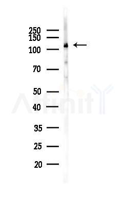 SRPK2 Antibody - Western blot analysis of lysates from HUVEC cells(LPS,4h treatment), using SRPK2 Antibody at 1/1000 dilution.