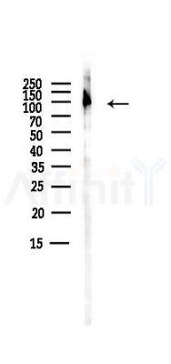 PSD95 Antibody - Western blot analysis of lysates from PC12 cells(LPS,4h treatment), using PSD95 Antibody at 1/1000 dilution.