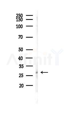Rab8 Antibody - Western blot analysis of lysates from HUVEC cells(LPS,4h treatment), using Rab8 Antibody at 1/1000 dilution.