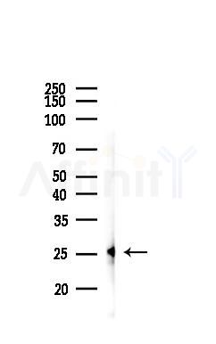 Rab8 Antibody - Western blot analysis of lysates from PC12 cells, using Rab8 Antibody at 1/1000 dilution.