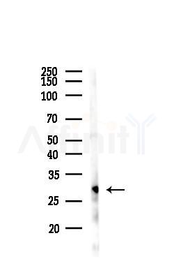 SNAP25 Antibody - Western blot analysis of lysates from PC12 cells, using SNAP25 Antibody at 1/1000 dilution.