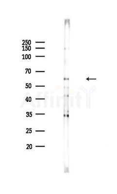 MAP3K8/COT Antibody - Western blot analysis of lysates from Hela cells(heat-shock,45min treatment), using MAP3K8/COT Antibody at 1/1000 dilution.