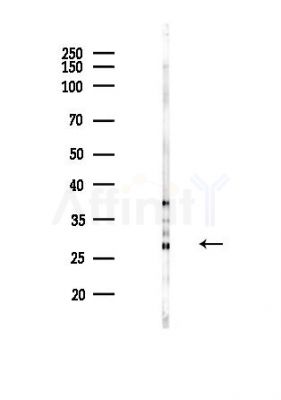 AQP2 Antibody - Western blot analysis of lysates from Hela cells(heat-shock,45min treatment), using AQP2 Antibody at 1/1000 dilution.