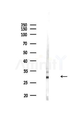 AQP2 Antibody - Western blot analysis of lysates from HUVEC cells(heat-shock,45min treatment), using AQP2 Antibody at 1/1000 dilution.