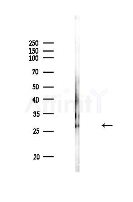 AQP2 Antibody - Western blot analysis of lysates from PC12 cells, using AQP2 Antibody at 1/1000 dilution.