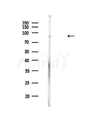 MARK3 Antibody - Western blot analysis of lysates from HUVEC cells(heat-shock,45min treatment), using MARK3 Antibody at 1/1000 dilution.