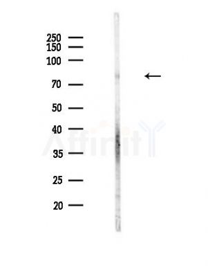 MARK3 Antibody - Western blot analysis of lysates from Hela cells(heat-shock,45min treatment), using MARK3 Antibody at 1/1000 dilution.