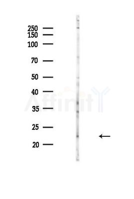 Phospholamban Antibody - Western blot analysis of lysates from Hela cells(heat-shock,45min treatment), using Phospholamban Antibody at 1/1000 dilution.