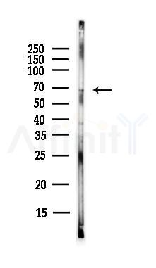 YY1 Antibody - Western blot analysis of lysates from EC304 cells(heat-shock,45min treatment), using YY1 Antibody at 1/1000 dilution.
