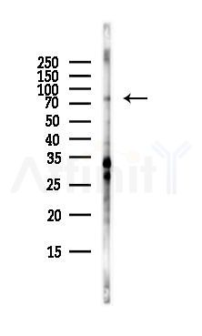GRK2 Antibody - Western blot analysis of lysates from RAW264.