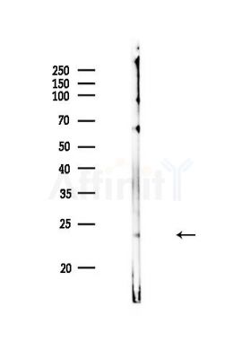 Rab3A Antibody - Western blot analysis of lysates from PC12 cells, using Rab3A Antibody at 1/1000 dilution.