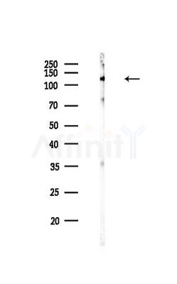 N Cadherin Antibody - Western blot analysis of lysates from HUVEC cells(heat-shock,45min treatment), using N Cadherin Antibody at 1/1000 dilution.