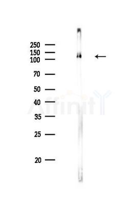 N Cadherin Antibody - Western blot analysis of lysates from PC12 cells, using N Cadherin Antibody at 1/1000 dilution.