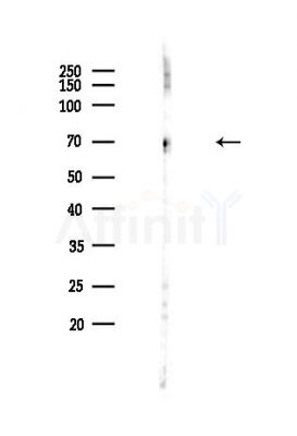Moesin/Ezrin/Radixin Antibody - Western blot analysis of lysates from Hela cells(heat-shock,45min treatment), using Moesin/Ezrin/Radixin Antibody at 1/1000 dilution.