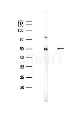 PKA R2 Antibody - Western blot analysis of lysates from Hela cells(heat-shock,45min treatment), using PKA R2 Antibody at 1/1000 dilution.