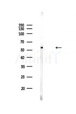 PKA R2 Antibody - Western blot analysis of lysates from HUVEC cells(heat-shock,45min treatment), using PKA R2 Antibody at 1/1000 dilution.