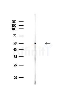 PKA R2 Antibody - Western blot analysis of lysates from PC12 cells, using PKA R2 Antibody at 1/1000 dilution.