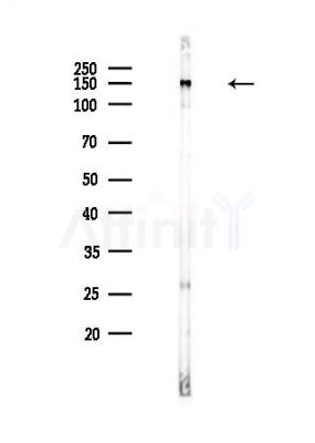 TOP2A Antibody - Western blot analysis of lysates from Hela cells(heat-shock,45min treatment), using TOP2A Antibody at 1/1000 dilution.
