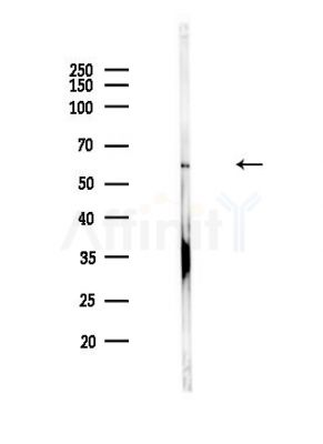 HSP60 Antibody - Western blot analysis of lysates from Hela cells(heat-shock,45min treatment), using HSP60 Antibody at 1/1000 dilution.