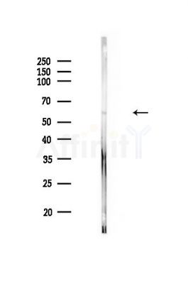 HSP60 Antibody - Western blot analysis of lysates from PC12 cells, using HSP60 Antibody at 1/1000 dilution.
