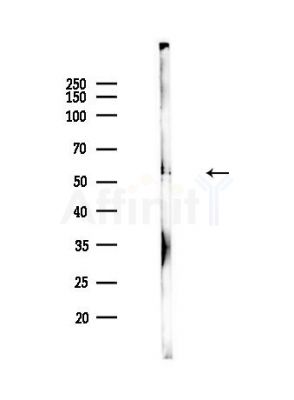 Hck/Lyn Antibody - Western blot analysis of lysates from Hela cells(heat-shock,45min treatment), using Hck/Lyn Antibody at 1/1000 dilution.