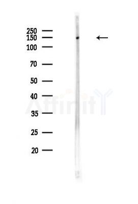 EPRS Antibody - Western blot analysis of lysates from Hela cells(heat-shock,45min treatment), using EPRS Antibody at 1/1000 dilution.