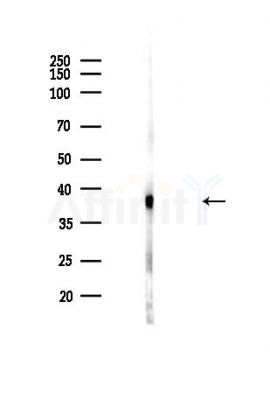 Nucleophosmin Antibody - Western blot analysis of lysates from Hela cells(heat-shock,45min treatment), using Nucleophosmin Antibody at 1/1000 dilution.