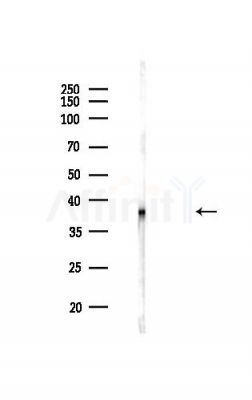 Nucleophosmin Antibody - Western blot analysis of lysates from HUVEC cells(heat-shock,45min treatment), using Nucleophosmin Antibody at 1/1000 dilution.