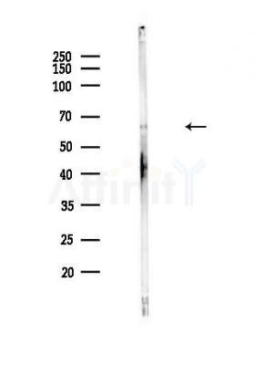 n-Myc Antibody - Western blot analysis of lysates from Hela cells(heat-shock,45min treatment), using n-Myc Antibody at 1/1000 dilution.