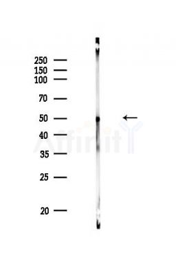 n-Myc Antibody - Western blot analysis of lysates from PC12 cells, using n-Myc Antibody at 1/1000 dilution.