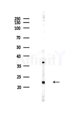 SOD2/MnSOD Antibody - Western blot analysis of lysates from Hela cells(heat-shock,45min treatment), using SOD2/MnSOD Antibody at 1/1000 dilution.