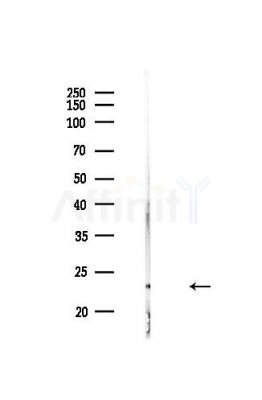 SOD2/MnSOD Antibody - Western blot analysis of lysates from HUVEC cells(heat-shock,45min treatment), using SOD2/MnSOD Antibody at 1/1000 dilution.