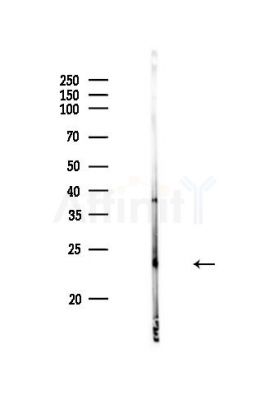 SOD2/MnSOD Antibody - Western blot analysis of lysates from PC12 cells, using SOD2/MnSOD Antibody at 1/1000 dilution.