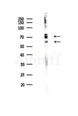 Lamin A/C Antibody - Western blot analysis of lysates from Hela cells(heat-shock,45min treatment), using Lamin A/C Antibody at 1/1000 dilution.