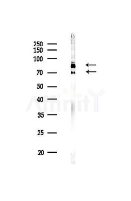 Lamin A/C Antibody - Western blot analysis of lysates from HUVEC cells(heat-shock,45min treatment), using Lamin A/C Antibody at 1/1000 dilution.