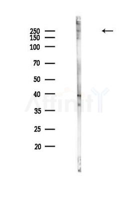 ABCA1 Antibody - Western blot analysis of lysates from Hela cells(heat-shock,45min treatment), using ABCA1 Antibody at 1/1000 dilution.