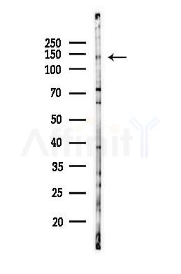 MYPT1 Antibody - Western blot analysis of lysates from EC304 cells(heat-shock,45min treatment), using MYPT1 Antibody at 1/1000 dilution.