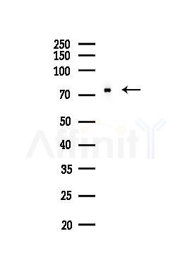 DDX3 Antibody - Western blot analysis of lysates from EC304 cells(heat-shock,45min treatment), using DDX3 Antibody at 1/1000 dilution.