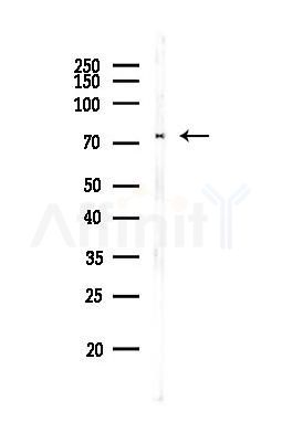 DDX3 Antibody - Western blot analysis of lysates from MCF7 cells(heat-shock,45min treatment), using DDX3 Antibody at 1/1000 dilution.
