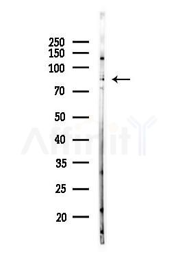IREB1 Antibody - Western blot analysis of lysates from EC304 cells(heat-shock,45min treatment), using IREB1 Antibody at 1/1000 dilution.