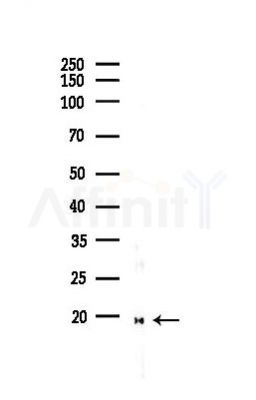 p23 Antibody - Western blot analysis of lysates from EC304 cells(heat-shock,45min treatment), using p23 Antibody at 1/1000 dilution.