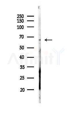 NF-kB p65 Antibody - Western blot analysis of lysates from EC304 cells(heat-shock,45min treatment), using NF-kB p65 Antibody at 1/1000 dilution.