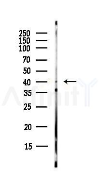 MKK3/MKK6 Antibody - Western blot analysis of lysates from EC304 cells(heat-shock,45min treatment), using MKK3/MKK6 Antibody at 1/1000 dilution.