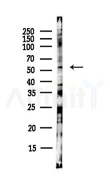 WEE1 Antibody - Western blot analysis of lysates from EC304 cells(heat-shock,45min treatment), using WEE1 Antibody at 1/1000 dilution.