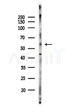 p57 Kip2 Antibody - Western blot analysis of lysates from EC304 cells(heat-shock,45min treatment), using p57 Kip2 Antibody at 1/1000 dilution.