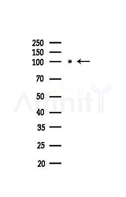 alpha 1 Catenin Antibody - Western blot analysis of lysates from Mouse liver, using alpha 1 Catenin Antibody at 1/1000 dilution.