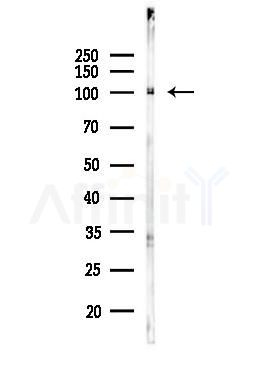 alpha 1 Catenin Antibody - Western blot analysis of lysates from EC304 cells(heat-shock,45min treatment), using alpha 1 Catenin Antibody at 1/1000 dilution.