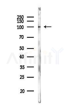 alpha 1 Catenin Antibody - Western blot analysis of lysates from MCF7 cells(heat-shock,45min treatment), using alpha 1 Catenin Antibody at 1/1000 dilution.