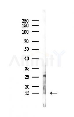 Histone H2A.X Antibody - Western blot analysis of lysates from EC304 cells(heat-shock,45min treatment), using Histone H2A.